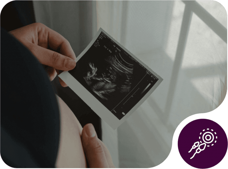 Fertility Assistance